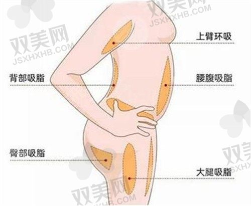 重庆军美医疗美容医院唐国强医生5G天使光雕吸脂5299元起，成效稳固
