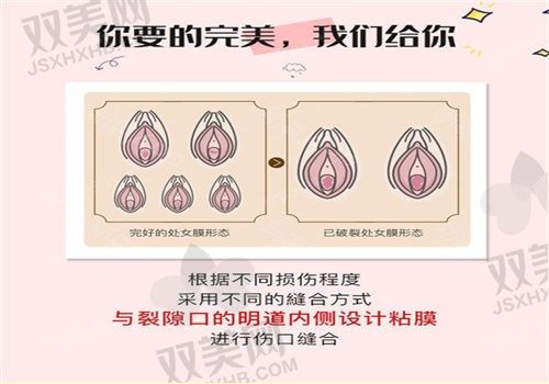 郑州中医药一附院房富平处女膜修复2000元起，术后效果自然