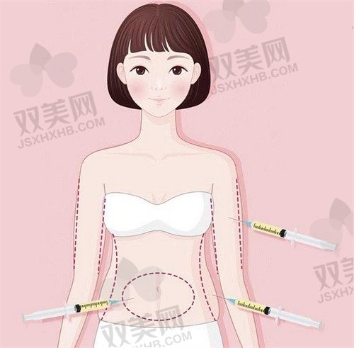 广州军美医疗美容医院王世虎吸脂填充塑形6800元起，重塑S曲线不是梦！