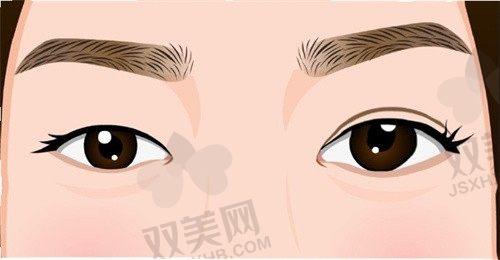 重庆美仑美奂医疗美容医院董开云眼修复8000元起，精雕细琢，重塑眼部神采！