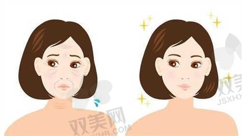 北京嘉禾李燕双眼皮修复怎么样？技术高价格不贵口碑还好速来预约