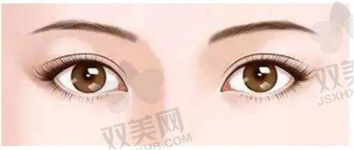 江苏南京施尔美美容整形医院双眼皮手术怎么样？医生团队打造自然灵动眼眸