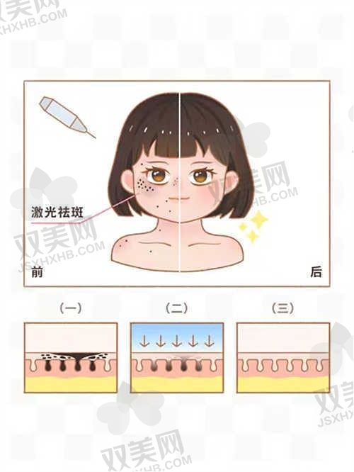 哈尔滨金流医疗美容诊所硅胶隆鼻3800元起，打造精致鼻型