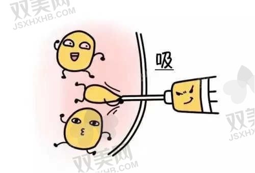 仙桃美来友好整形美容诊所胡霜红医生抽脂手术1.3W+，附医院简介