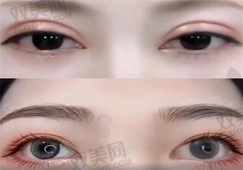 成都画美医疗美容医院黄元利高难度眼修复12800元起，程度口碑医生，可在线预约
