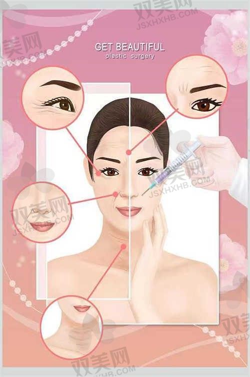 郑州艺龄医疗美容医院于洋双眼皮手术8800元起，项目介绍都在这！