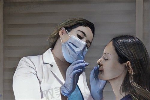 南宁华美整形医院卢志刚膨体隆鼻8330元，鼻尖精致挺翘，鼻梁自然流畅