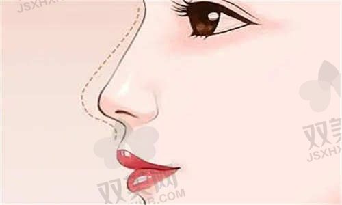 南通俪人连天美医疗美容医院的鼻整形价格3928元起，多种鼻整形方案量身定制