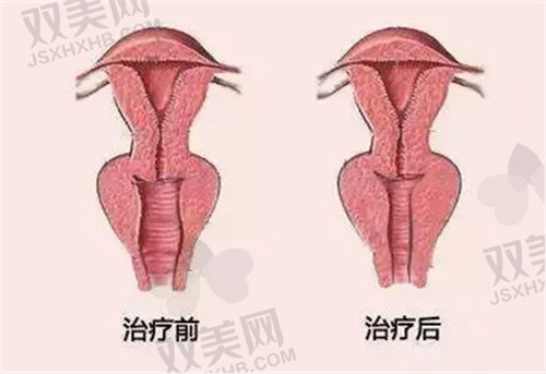 北京嘉禾整形医院侯智慧阴道紧缩9783元起
