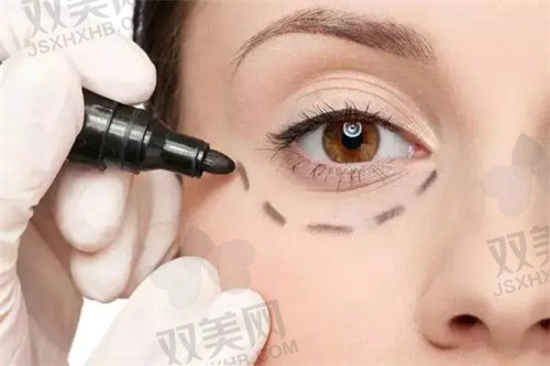 北京永成经典医疗美容祛眼袋多少钱
