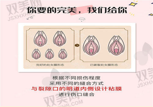 郑州中医药一附院房富平处女膜修复优势在哪？