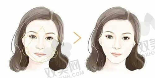 广州素美医疗美容医院眼整形怎么样