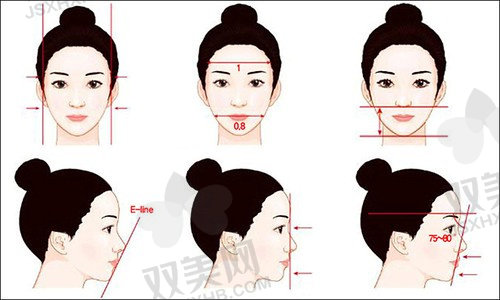 郑州东方整形医院 眼睑外翻怎么样.jpg