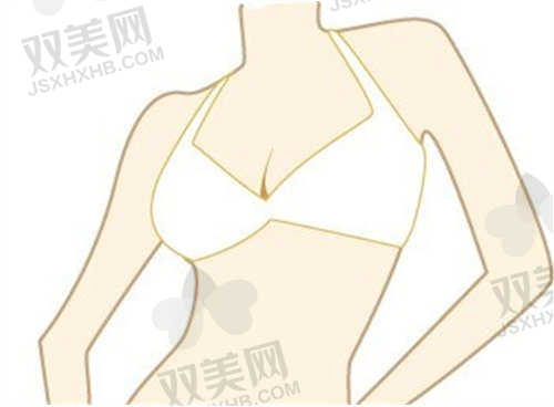 温州名人整形医院隆胸价格表