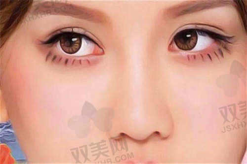 衡水唯美医疗美容医院特色手术项目