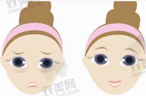 桂林华美整形美容门诊部自体隆鼻技术怎么样