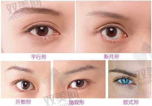 郑州艺龄医疗美容医院艺速美眼怎么样