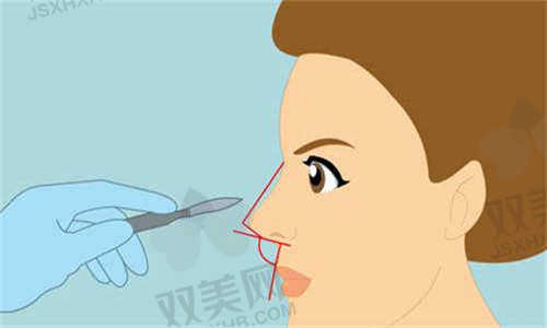 天津与时宜美医疗美容鼻综合整形技术优势