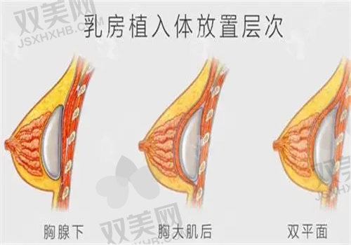 厦门海峡医疗美容刘歆傲诺拉丰胸5800元起