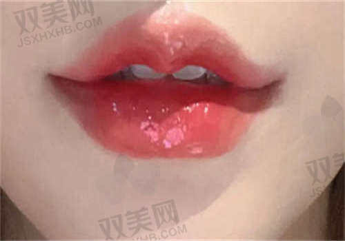 菏泽恩缇医疗美容医院技术优势分析