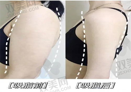 武汉星薇莱医疗美容始患者评价，真实反馈，值得信赖！