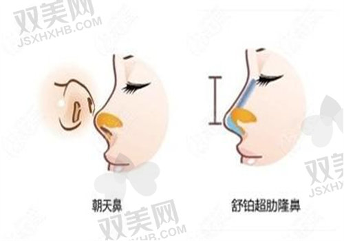 广州广大整形医院怎么样？
