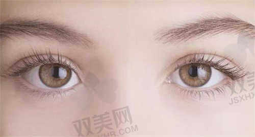 郑州安佳美容整形医院微创双眼皮技术怎么样好不好