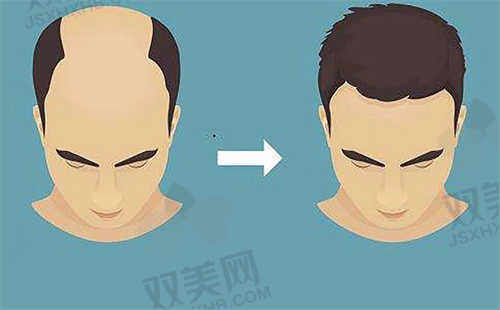 成都恒美毛发医疗美容医院