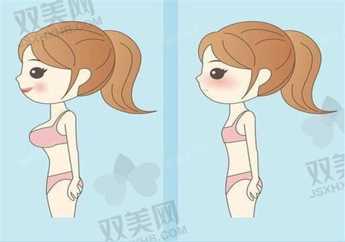 深圳今喜曹孟君做活细胞丰胸多少钱