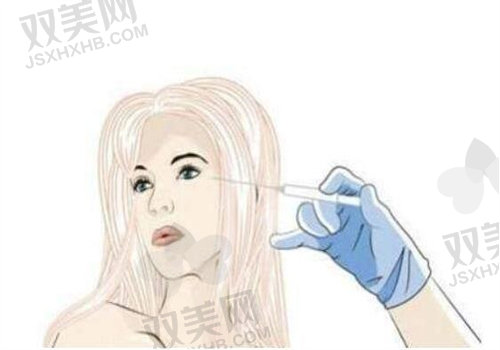 2025奥美定取出\生长因子取出实例
