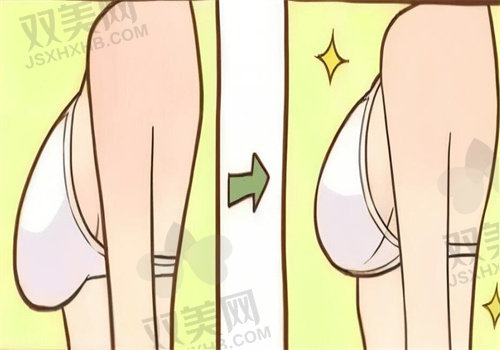 泰国二合一丰胸针原理