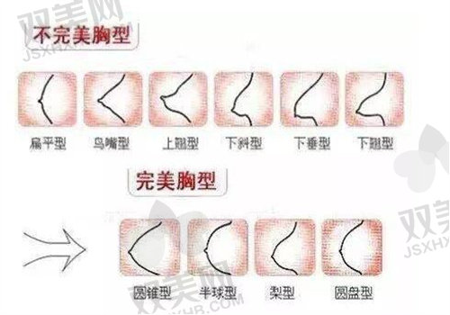 泰国二合一丰胸针优势