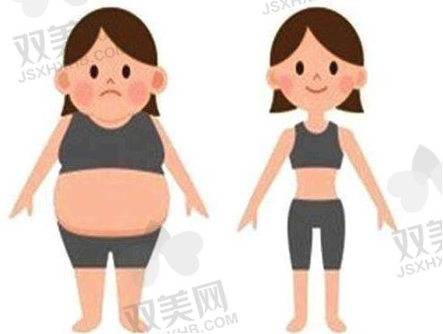 冯斌腰腹吸脂真实实例对比