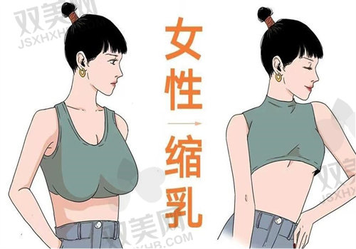 2025年les平胸手术价格表