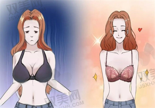 2025年les平胸手术多少钱