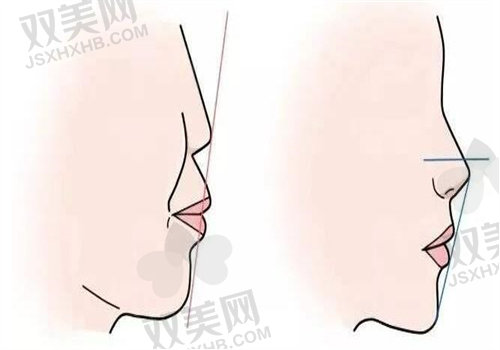 肖林医生的擅长项目