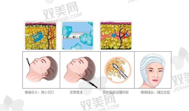 QQ浏览器截图20210910175533.png