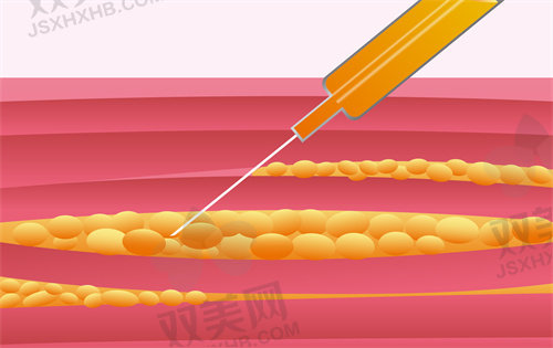 北京黎星医生做修复怎么样