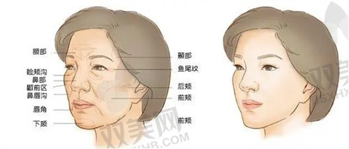 北京金圣医疗美容诊所面部脂肪填充做得好