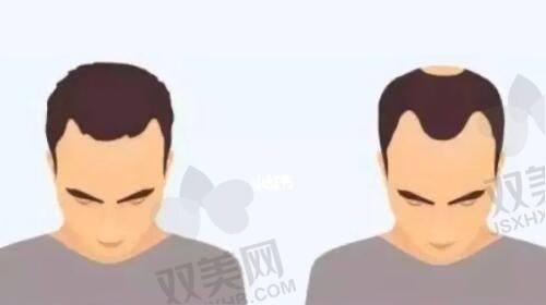 李方伟医生富贵包治疗价格明细