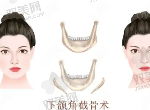 手术技术优势