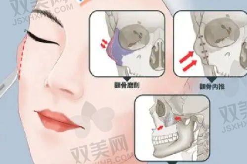 手术评价反馈