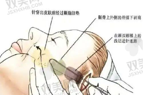 口碑评价