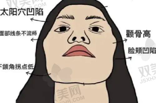 我亲测注射玻尿酸，效果究竟能维持多久？有无副作用和恢复期，都给你说清！