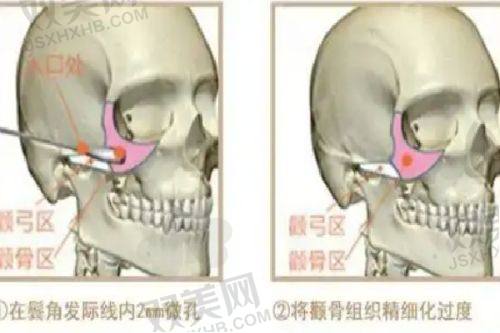 四、预约方式