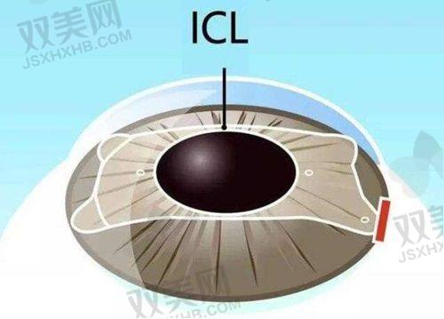 六、“医生决定小命，机器决定体验”——设备一分钱也不能省！