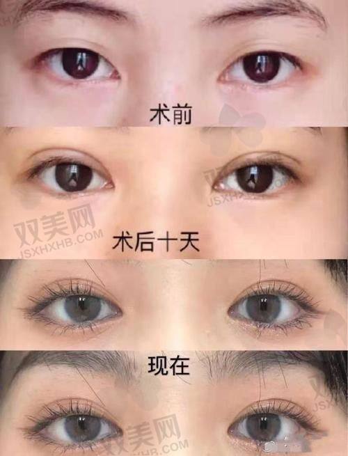 七、小编总结：黄军伟三点定位推荐指数爆表，适合这几类姐妹！