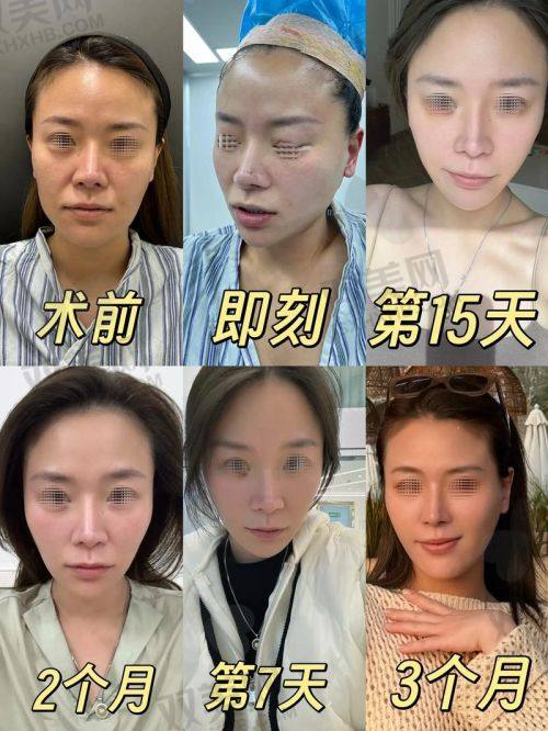 预约方式