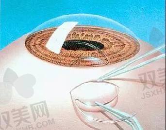 四、贵阳这类项目到底值不值？对比其他医院打打样！
