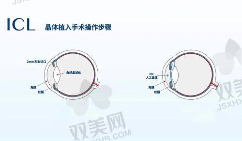 五、如何合理选套餐？省钱攻略看这里！